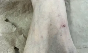 Nhập viện vì tự 'giải độc' vết mèo cắn bằng nước chanh