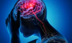 Thường xuyên giận dữ, lo âu dễ đột quỵ?